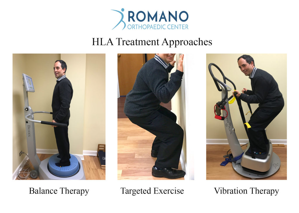 RomanoMD HLA Treatment options, orthopaedics, hla, knee injections