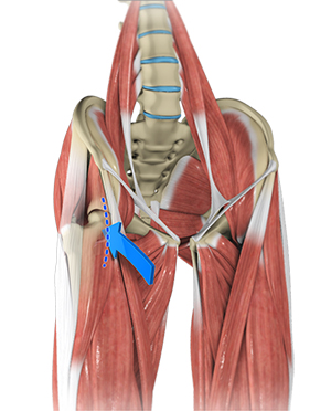 Anterior Hip Replacement