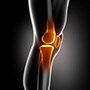 Non-Surgical Knee Treatments