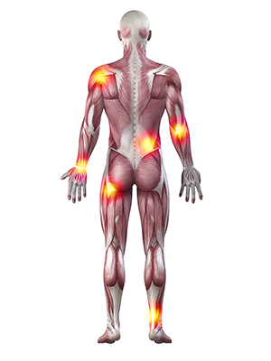 Muskuloskeletal Injuries