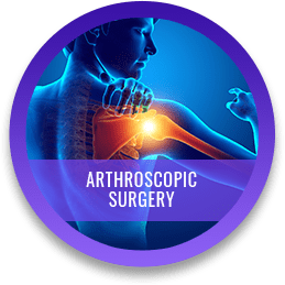 Arthroscopy Surgery