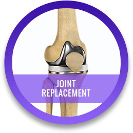 Joint Replacement