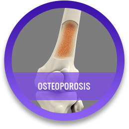 Osteoporosis